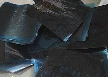 rontgen film hurdasi